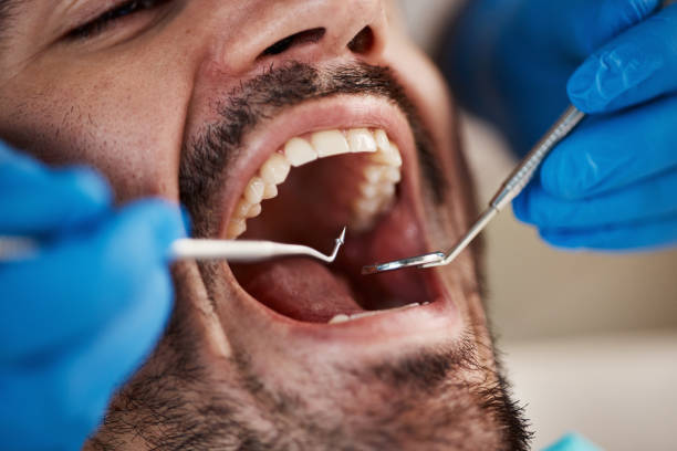 Best Wisdom Tooth Removal  in Jonesville, MI